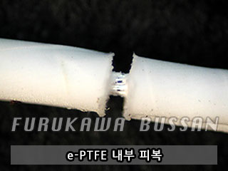 e-PTFE内部被覆